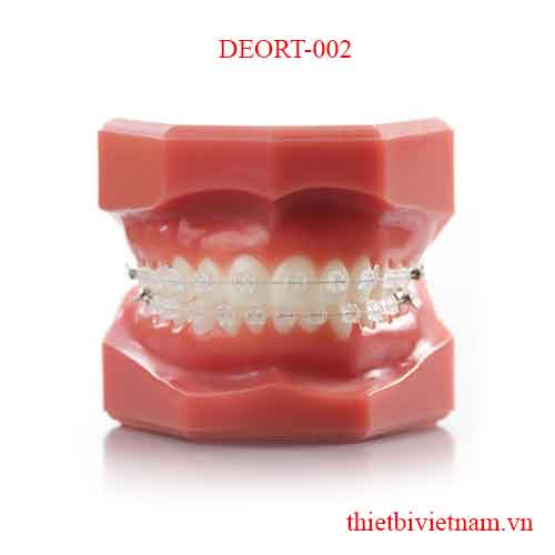 CERAMIC BRACKETS TUBES AND WIRES ARE MADE WITH METAL DEORT-002