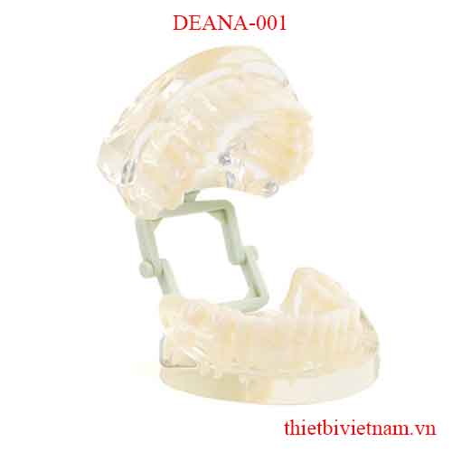 DEANA-001 TRANSPARENT JAW MODEL