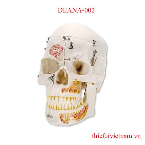 DEANA-002 10 PIECE DEMONSTRATION SKULL