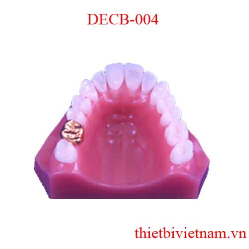 DECB-004 CROWN AND BRIDGE