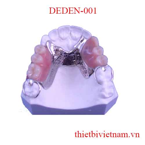 DEDEN-001 PARTIAL METAL DENTURE