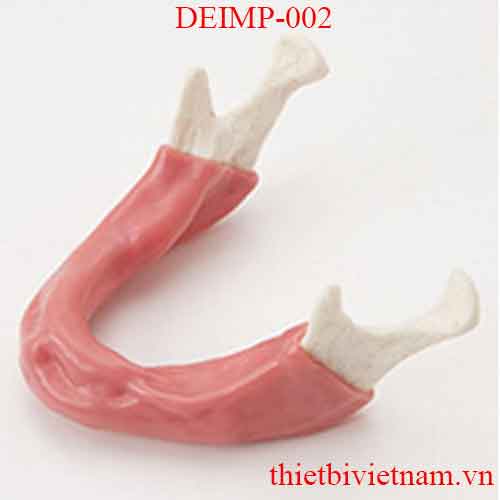 DEIMP-002 MANDIBLE WITH SOFT TISSUE