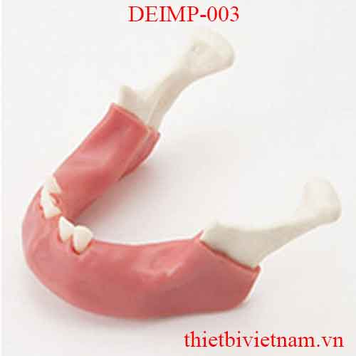 DEIMP-003 MANDIBLE WITH SOFT TISSUE