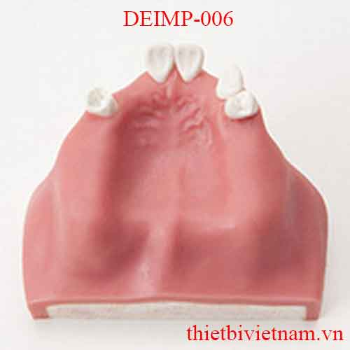 DEIMP-006 IMPLANT SINUS LIFTING PRACTICE MODEL