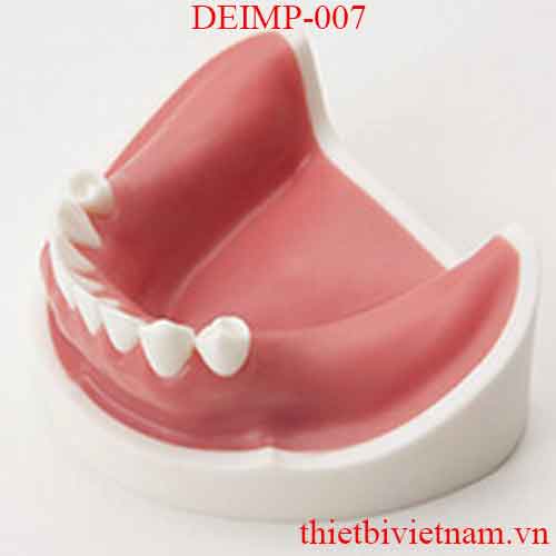 DEIMP-007 IMPLANT LOWER BASIC TRAINING MODEL WITH GINGIVAE