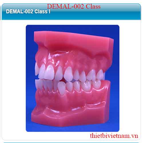MALOCCULUSION MODELS DEMAL-002 Class I