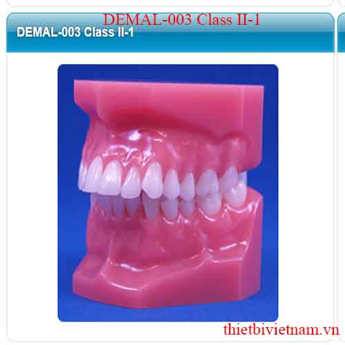 MALOCCULUSION MODELS DEMAL-003 Class II-1