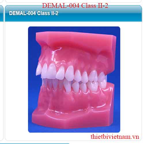 MALOCCULUSION MODELS DEMAL-004 Class II-2