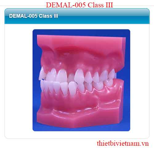 MALOCCULUSION MODELS DEMAL-005 Class III  