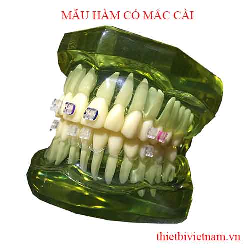 MẪU HÀM CÓ MẮC CÀI