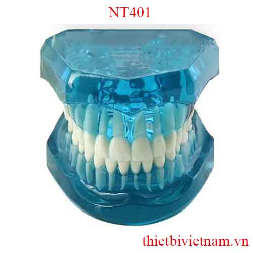 MẪU HÀM RĂNG BẰNG NHỰA TRONG NT401