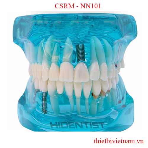 MẪU HÀM TƯ VẤN BỆNH LÝ 5 IN 1 CSRM - NN101