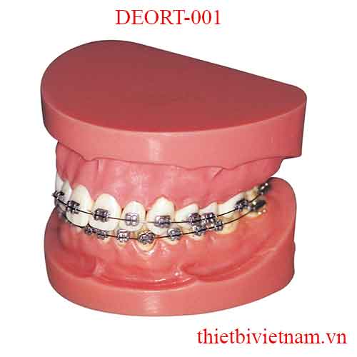 METAL BRACKETS AND TUBES ARE WIRES DEORT-001 