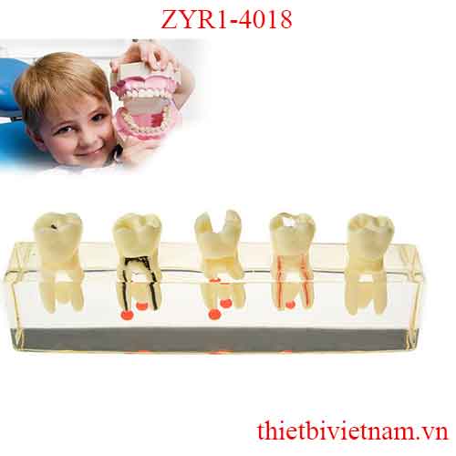 MÔ HÌNH RĂNG HÀN QUỐC ZYR1-4018 